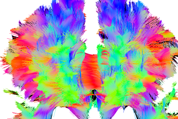Darstellung des Gehirns, farblich unterteilt 