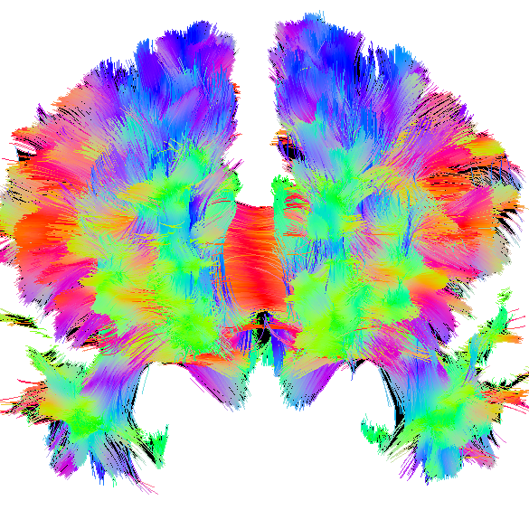 Darstellung des Gehirns, farblich unterteilt 